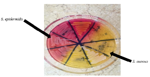 Detection of Staphylococcus aureus Enterotoxins in Raw and Processed Milk in Khartoum State, Sudan